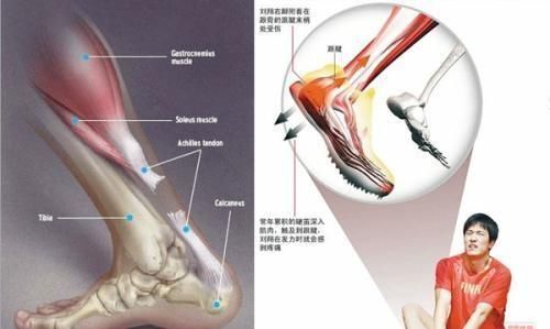 跟腱断裂后的杜兰特真的下滑了吗图3