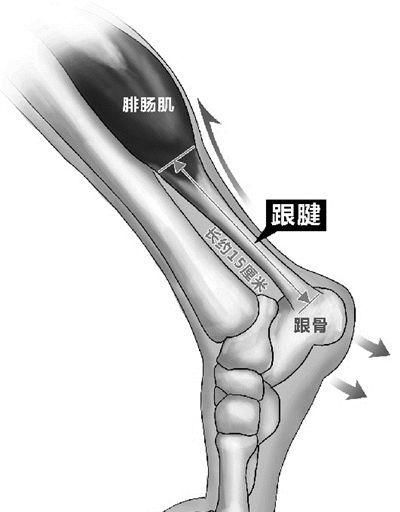 跟腱受伤对杜兰特影响有多大图1