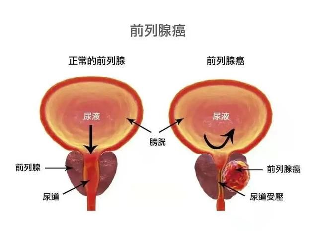 照现在的医学水平发展下去，癌症这个医学难题将来能攻克吗，大概需要多长时间图4