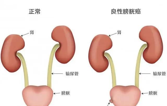 照现在的医学水平发展下去，癌症这个医学难题将来能攻克吗，大概需要多长时间图10