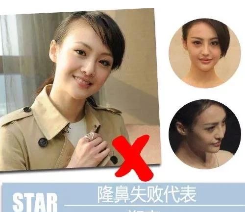 为什么一些明星会整容呢明明整完没有自然的好看图2